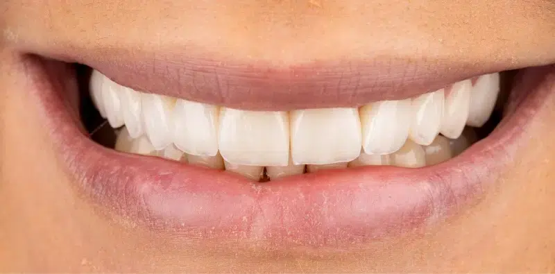 After Dental Treatment - Tri City Dental Care