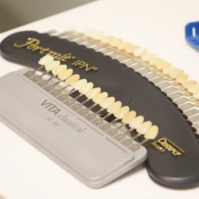 Dental Bonding in Kennewick,-Dental Bonding in Kennewick, WA - Tri City Dental Care